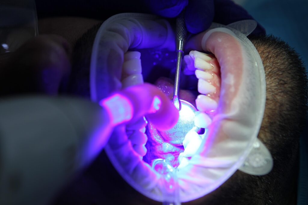 Riscos associados ao clareamento dos dentes
